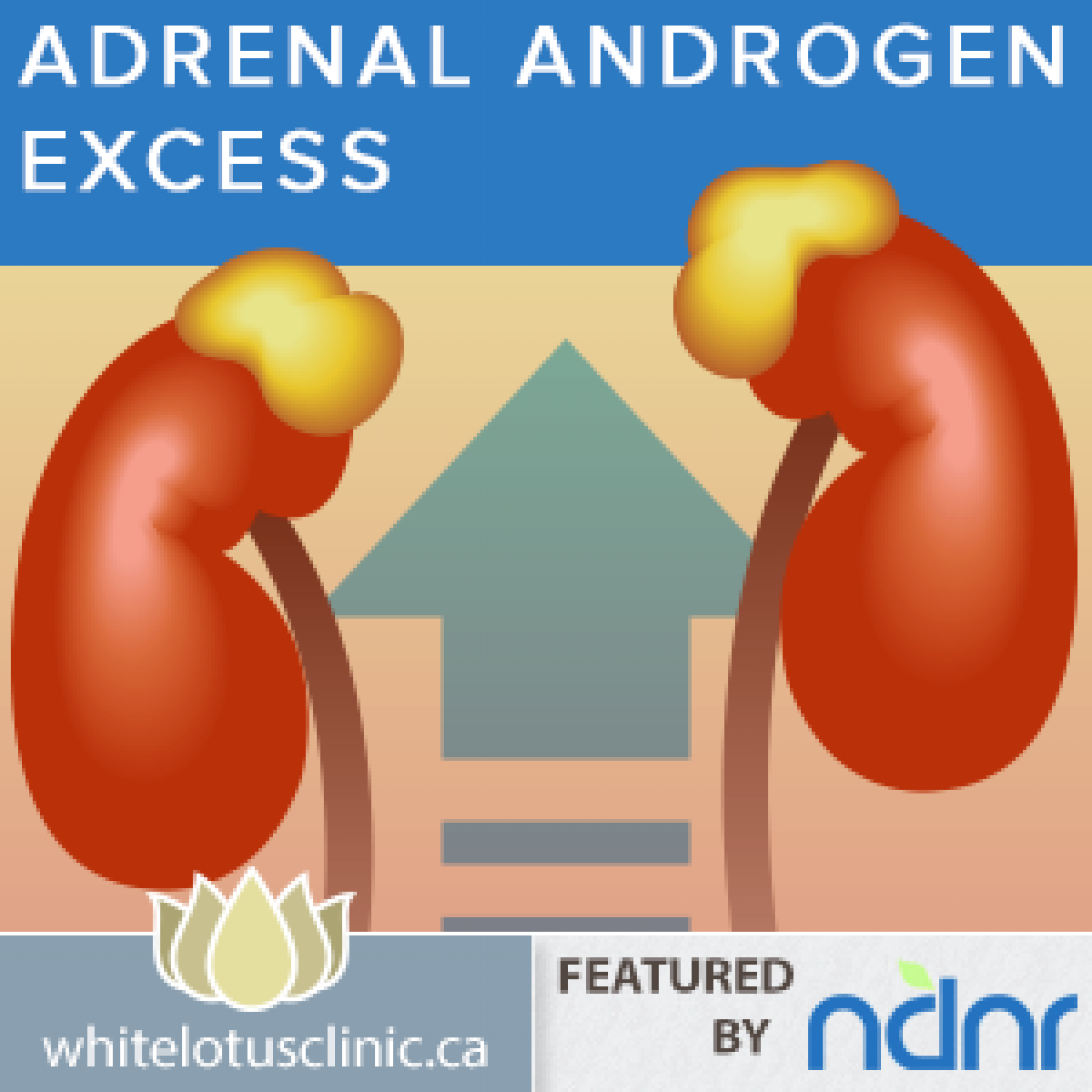 PCOS Treating Adrenal Androgen Excess White Lotus Clinic