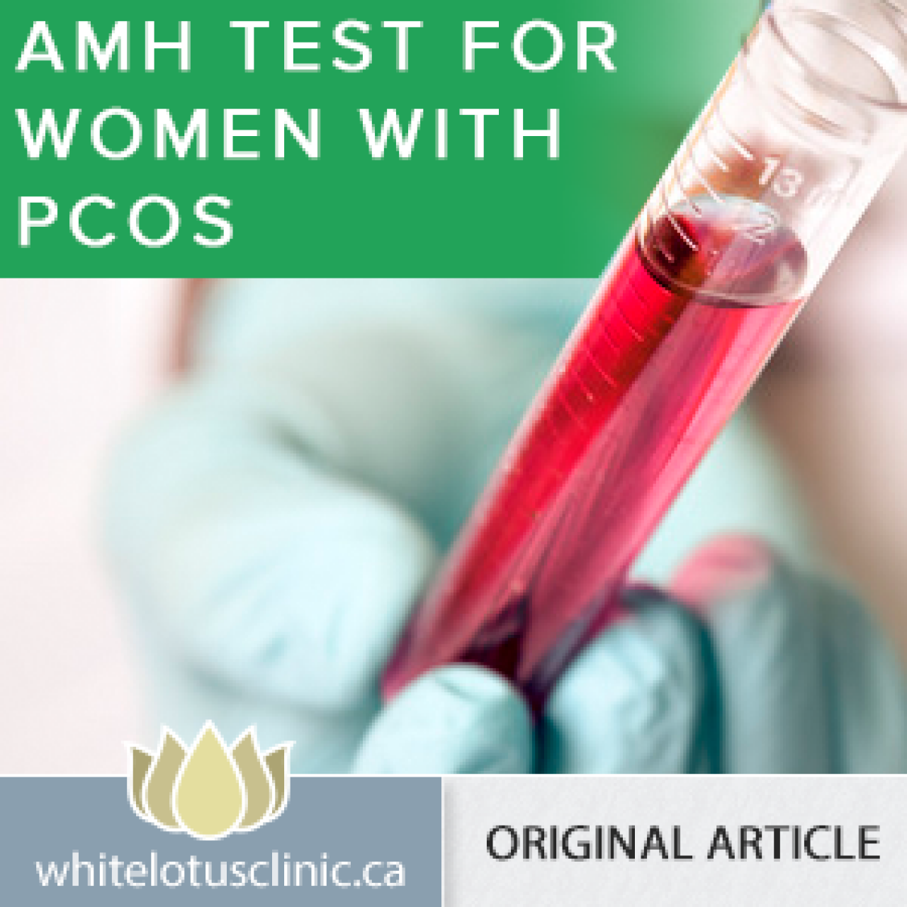 AMH Test for Women with PCOS