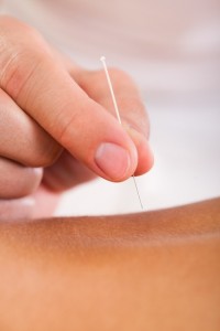 Electro Acupuncture IVF