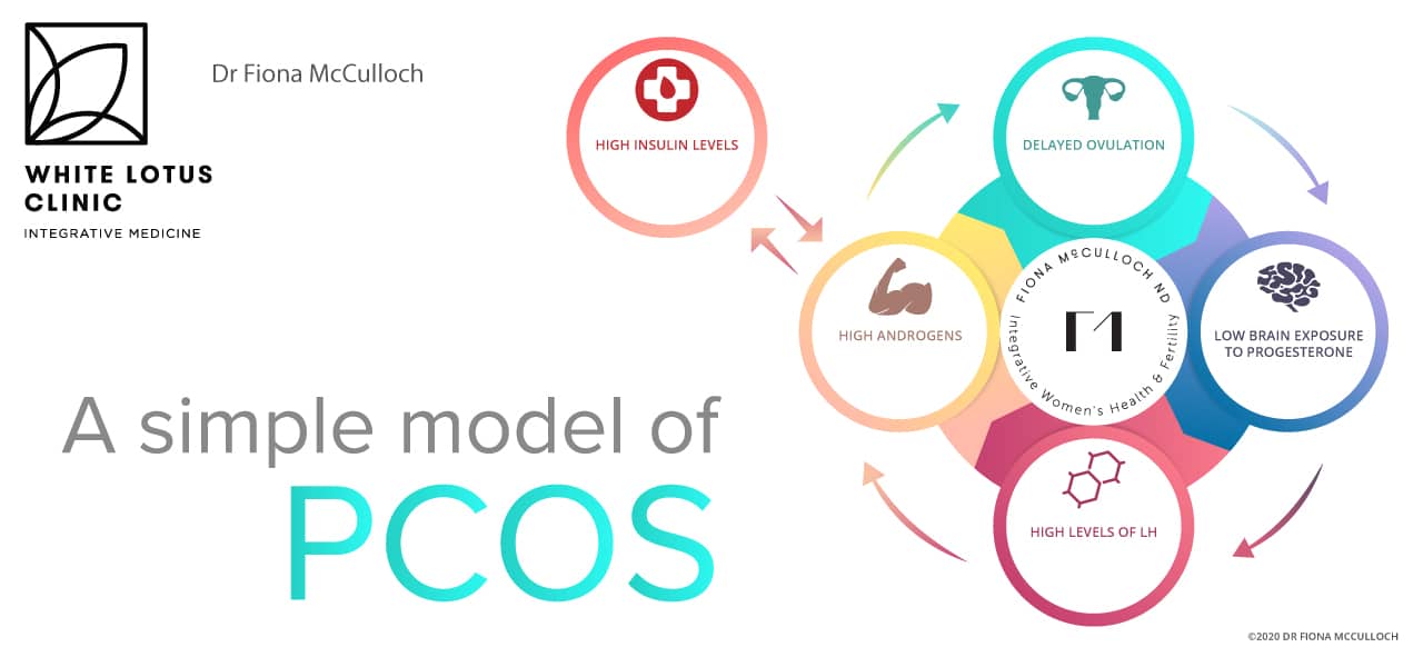 PCOS - 2020 Simplified Model from Dr Fiona McCulloch ND