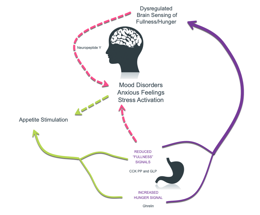 Stress and Hunger in PCOS